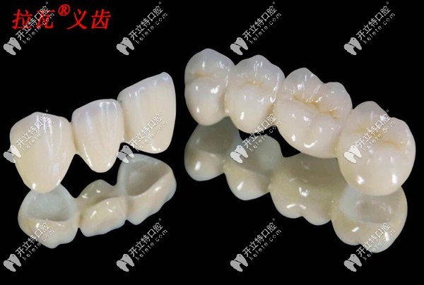 拉瓦全瓷牙貴不貴