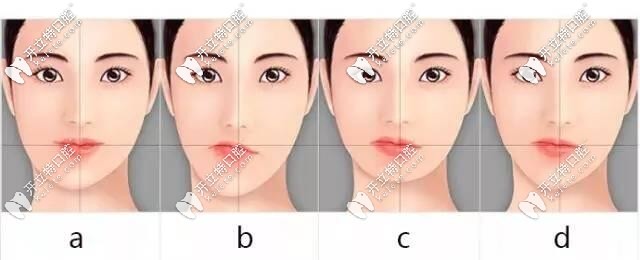 單側(cè)咀嚼歪臉圖