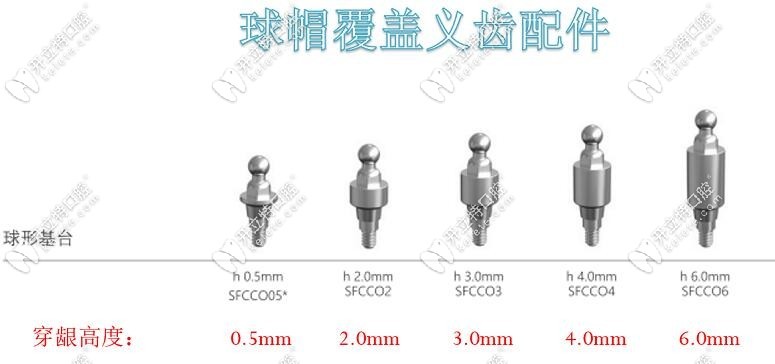球帽式半固定覆蓋義齒