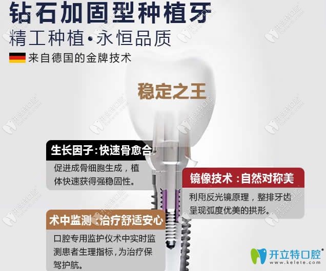 广州圣贝口腔钻石加固型种植牙技术