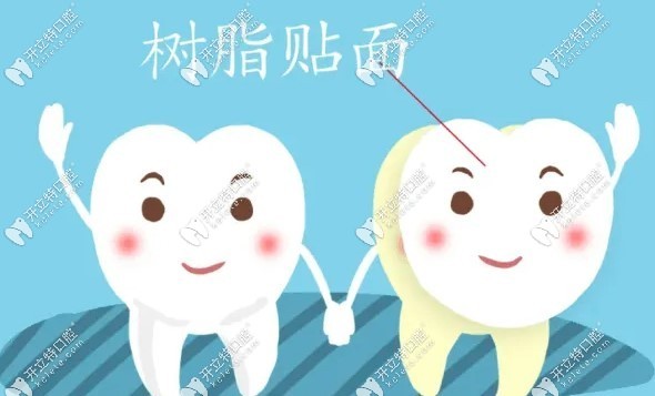 牙齿贴面做了后悔死了