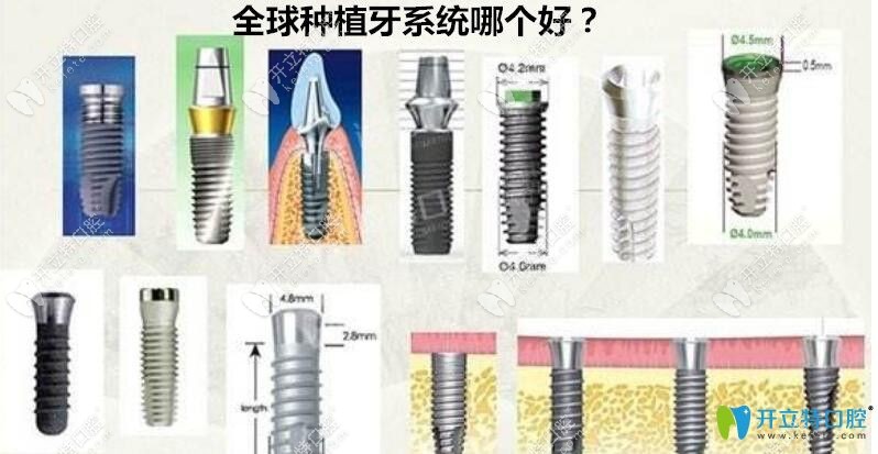 世界種植體品牌排名詳情一覽