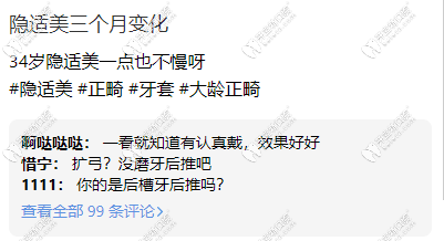 隐适美三个月变化蛮大
