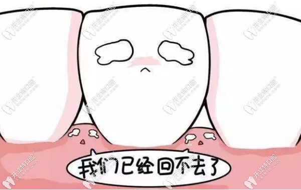 烤瓷牙不滿意可做全瓷牙