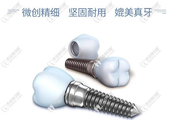 深圳光明新区种植牙多少钱kelete.com
