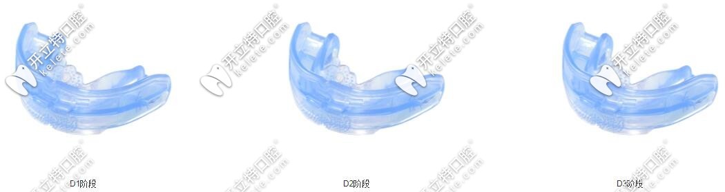D系列专注于反颌的矫治