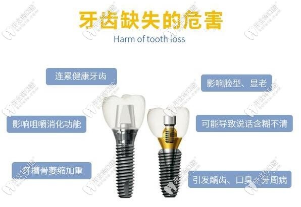 2023深圳光明新区种植牙价格表
