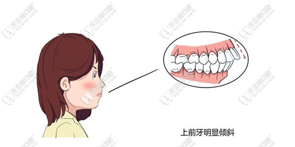 如何改善深覆蓋能拉出下巴kelete.com