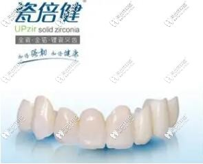 愛爾創(chuàng)瓷倍健全瓷牙