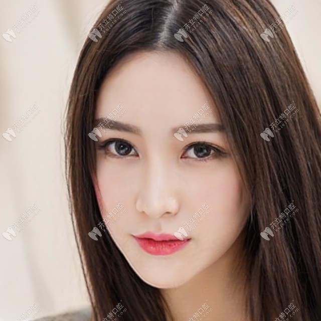 深覆合深覆蓋為什么會下巴后縮?如何改善深覆蓋能拉出下巴