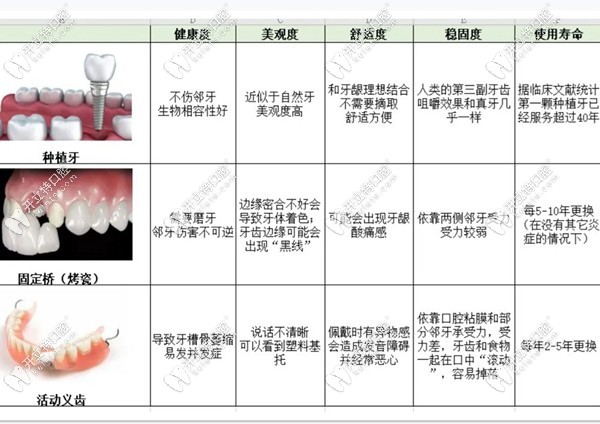 種植牙和其他牙齒修復(fù)方式對比