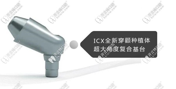 ICX全新穿颧种植体超大角度复合基台