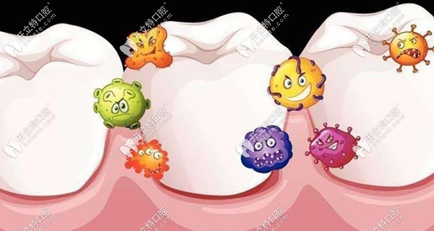 牙齿有菌落示意图
