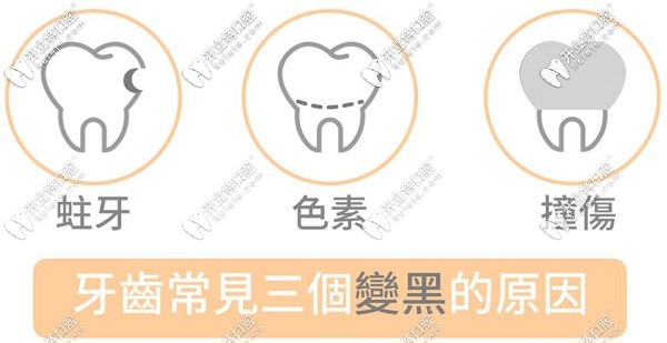 造成兒童牙齒黑斑的原因