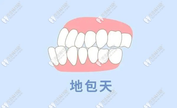 兒童地包天矯正費(fèi)用