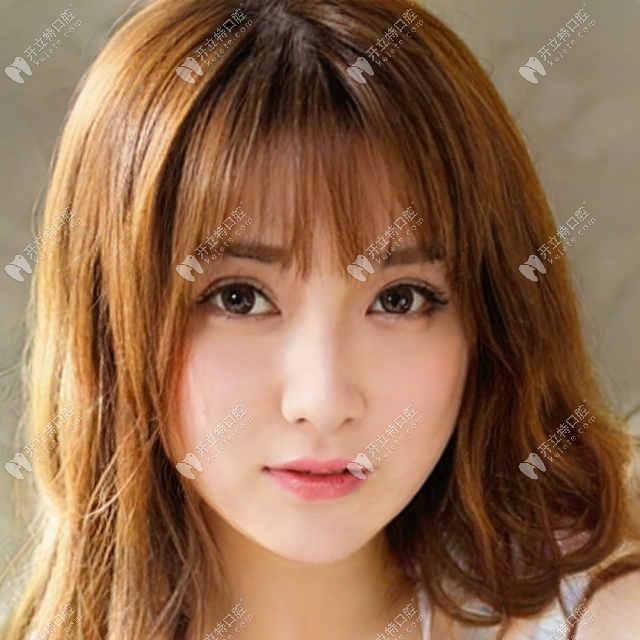 進(jìn)口熙直美種植體在韓國排第幾名?聽說csm親水的價格不貴