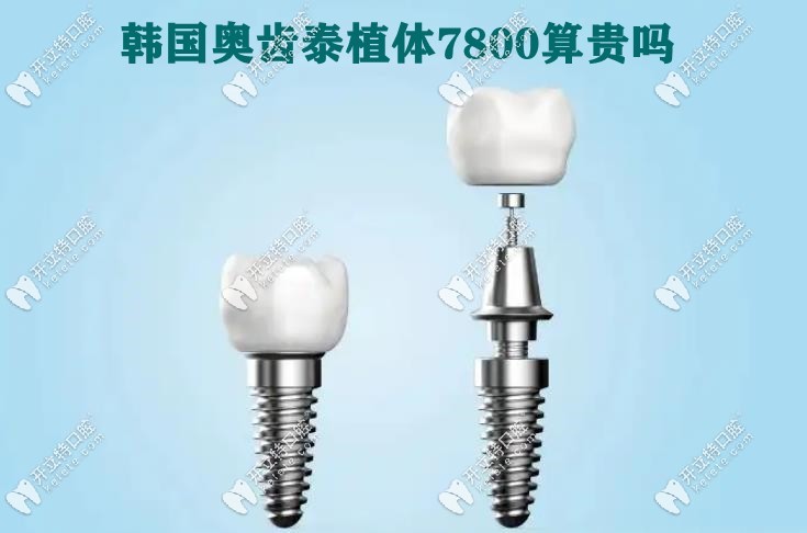奥齿泰7800算贵吗kelete.com
