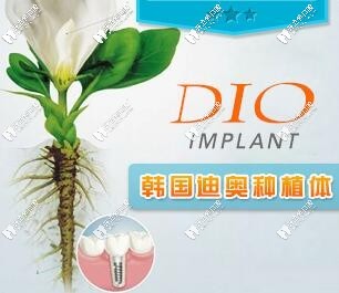 韓國(guó)DIO迪奧種植牙排名怎么樣