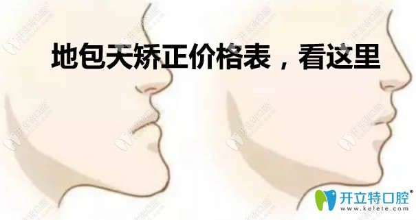 地包天矯正需要多少錢