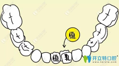 乳牙滯留恒牙萌出圖