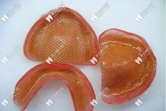 膠托鑄網(wǎng)活動義齒