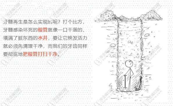 牙髓再生術是如何實現(xiàn)的kelete.com