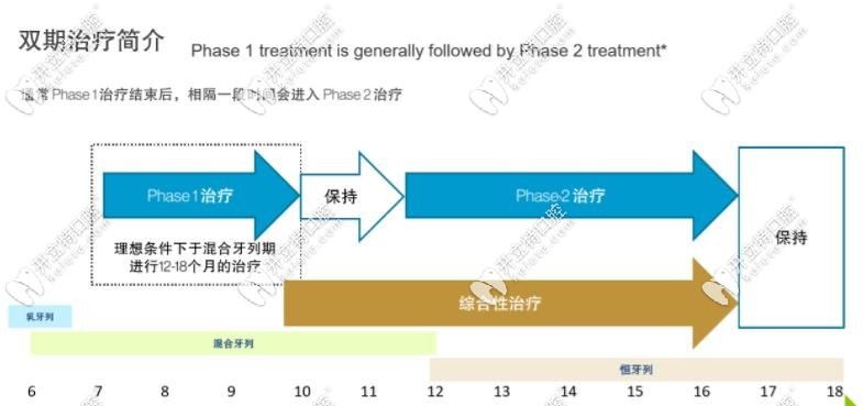 隐适美first分两期佩戴完成矫正