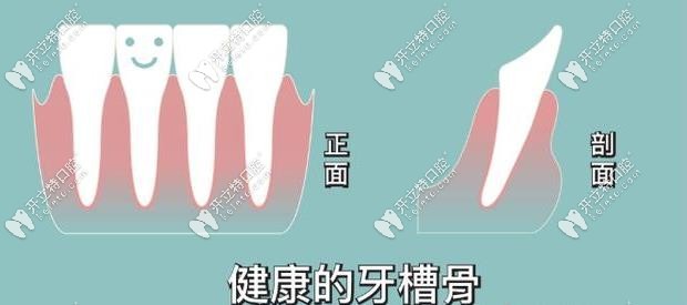 牙槽骨沒(méi)有吸收的樣子