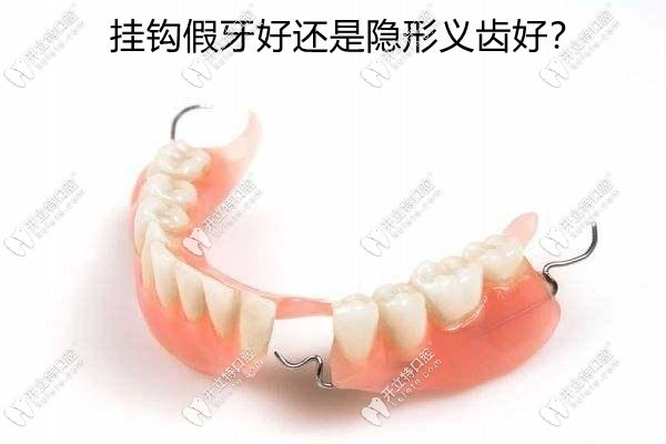 掛鉤假牙好還是隱形義齒好