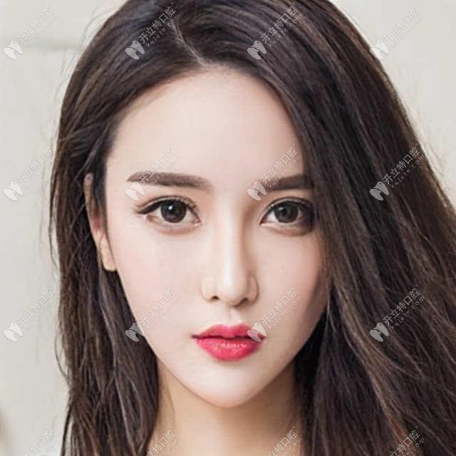 3歲寶寶乳牙深覆合需要干預(yù)矯正嘛，聽說換牙后能緩解...