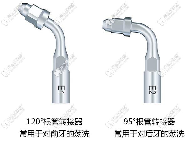 根管治療超聲蕩洗的流程