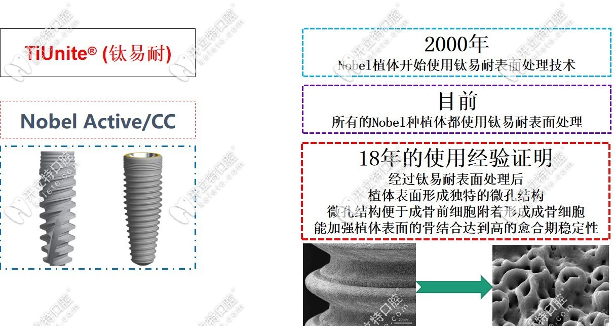 独有的钛易耐表面处理