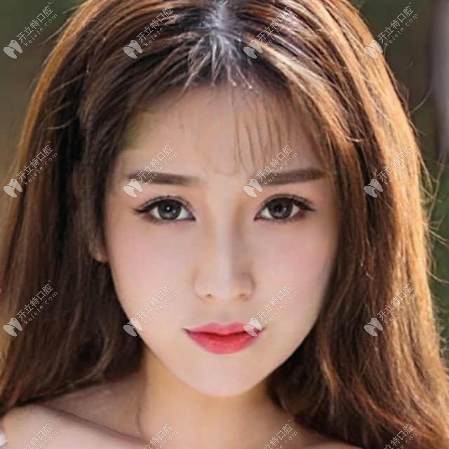德国瑞西欧ht植体和icx哪个好?钛材质不同是否影响使用寿命