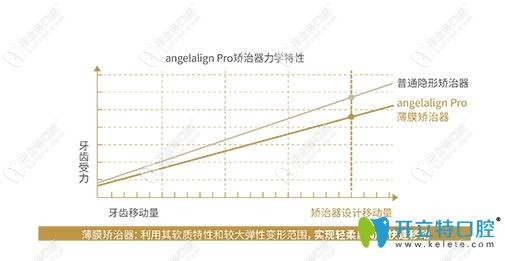 時代天使矯治器特性