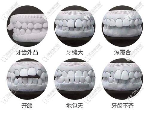 隱適美full