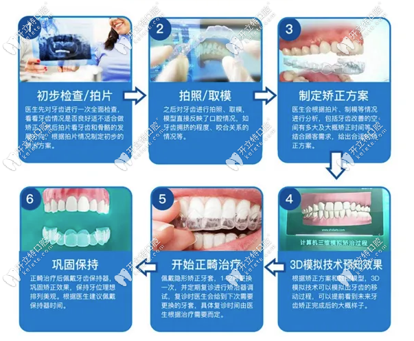 牙齒矯正的過程