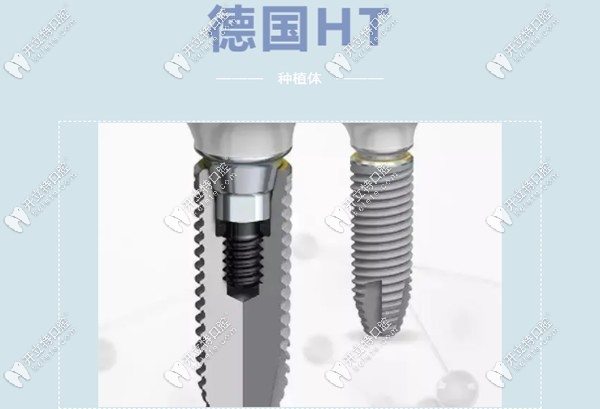 德国瑞西欧ht种植体怎么样