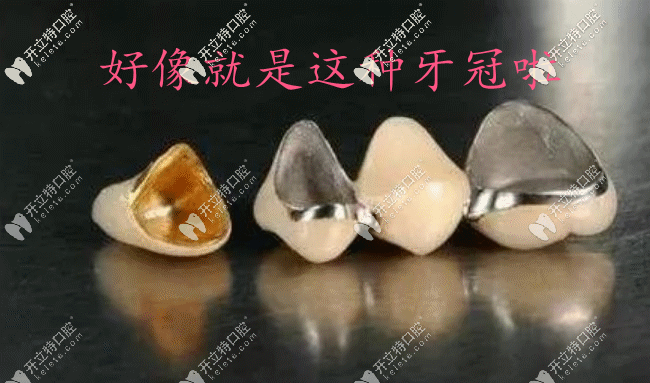 我剛開始選擇的金屬牙冠