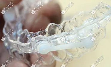 通過計(jì)算機(jī)輔助三維診斷