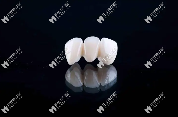 全瓷牙便宜的和貴的區(qū)別在哪gh0097.com