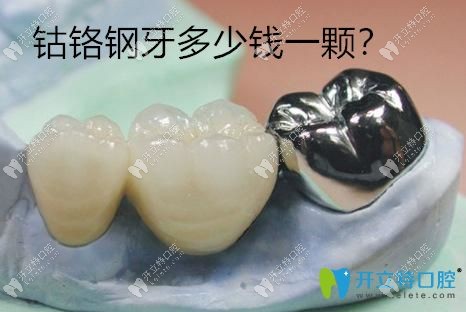 钴铬钢牙价格多少钱