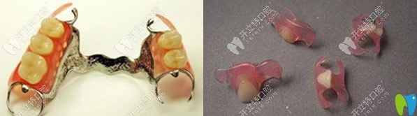 福州登特口腔活动假牙