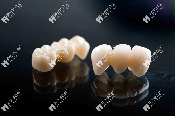 全瓷牙套多少錢價格表2023