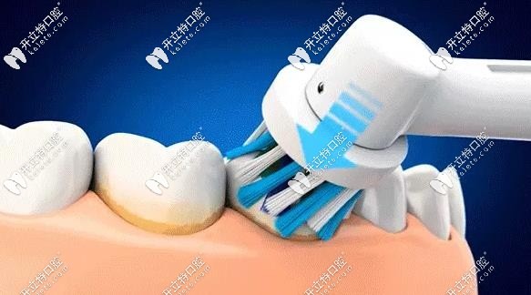 旋轉(zhuǎn)類牙刷