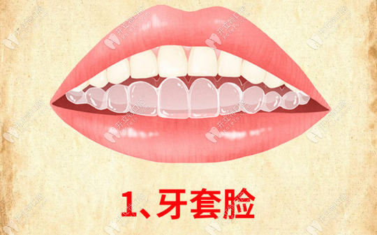牙齿矫正后脸垮了