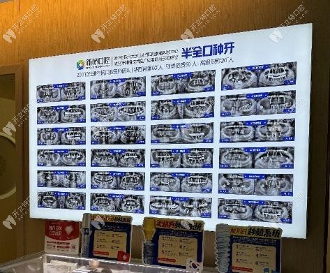 新桥口腔吸附性义齿价格表