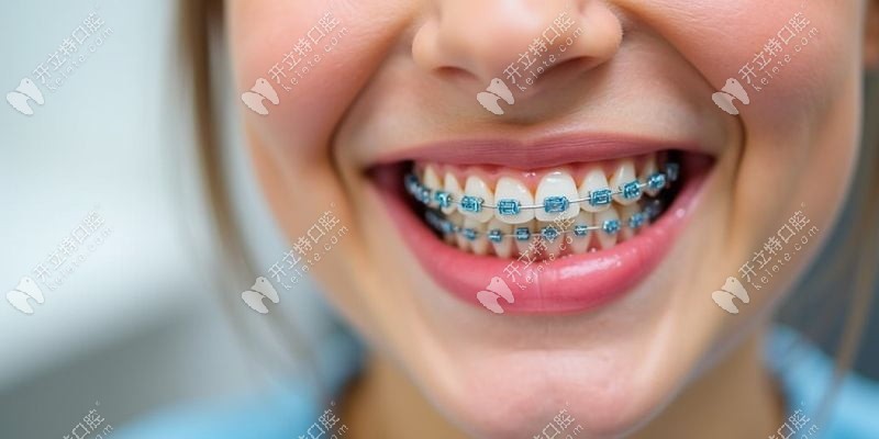 漳州第三醫(yī)院口腔科全瓷牙修復(fù)實(shí)例分享：從困擾到自信的轉(zhuǎn)變