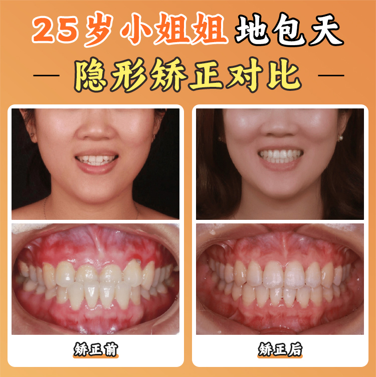 北医三院正颌手术推荐医生2：王晓霞（颌面外科）www.kelete.com
