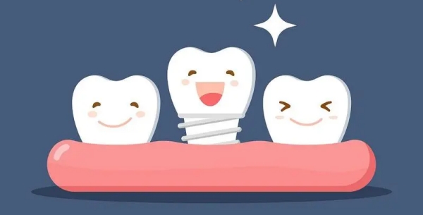 應(yīng)彬彬醫(yī)生種植牙