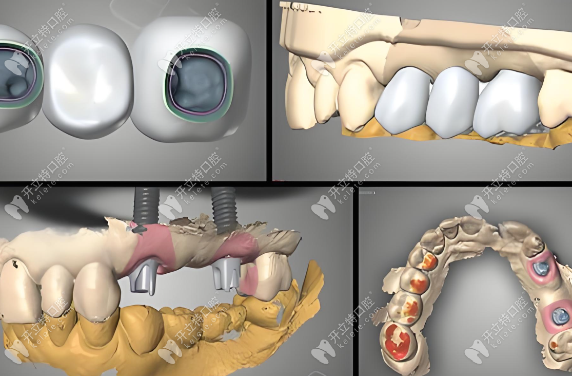 黄志擅长数字化舒适种植 黄志擅长数字化舒适种植